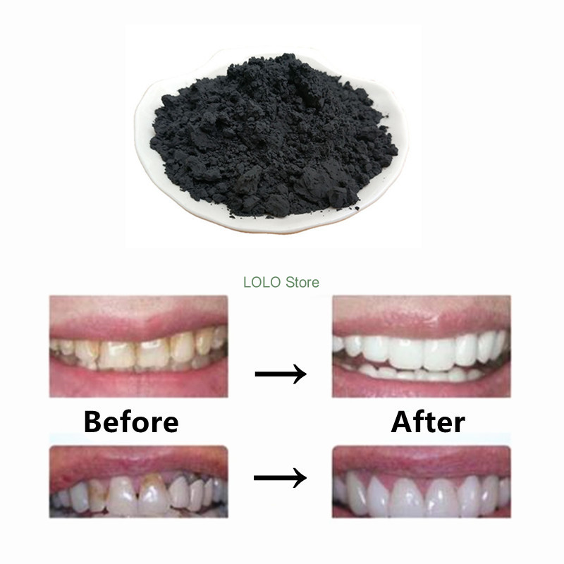 Reine Holzkohle Pulver, Aktivi – Activated Charcoal Powder Bewertung und Preis